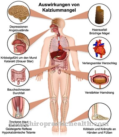 хипокалциемия