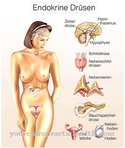 Hypoparathyroidism (underactive parathyroid gland)