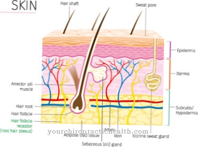 Ichthyosis (ichthyosis)