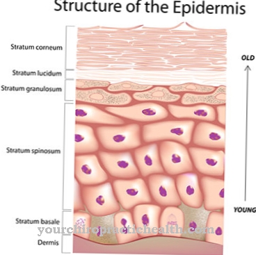 Ichtyosis vulgaris