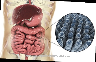 Iskæmisk colitis