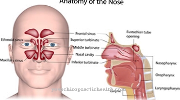 Kallmann syndrome