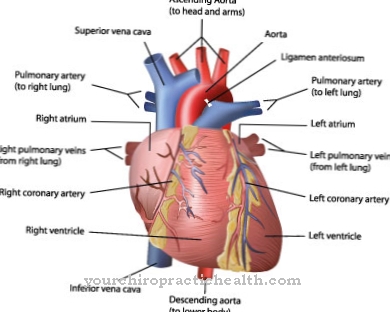 Cardiogenic shock