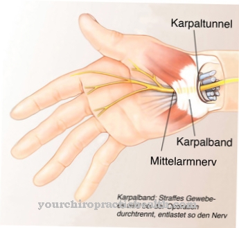 Karpālā tuneļa sindroms