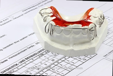 Jaw misalignment (tooth misalignment)