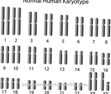 Syndrome de Klinefelter