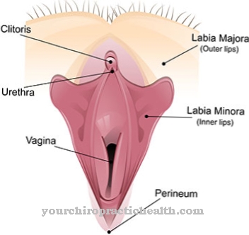 การเจริญเติบโตมากเกินไปของ Clitoral