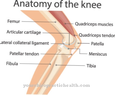 Kneecap arthrosis