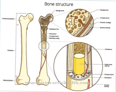 Inflammation of the bones