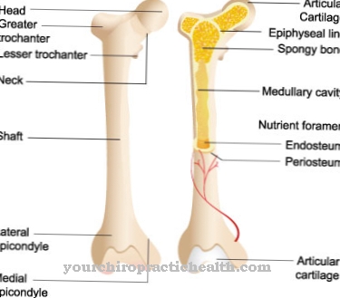 Bone cyst