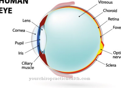 Coloboma