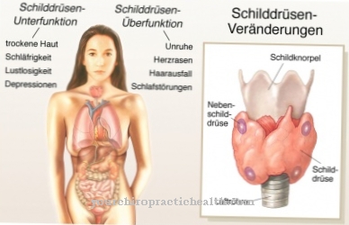 Schildklieraandoeningen