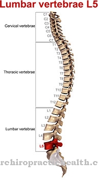 L5 syndrome