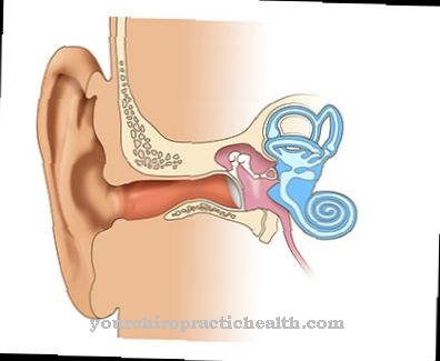 Labyrinthitis