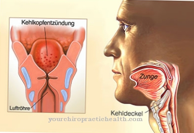 Gastric laryngitis