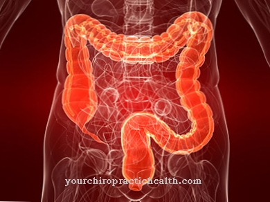 Leaky Gut Syndrome