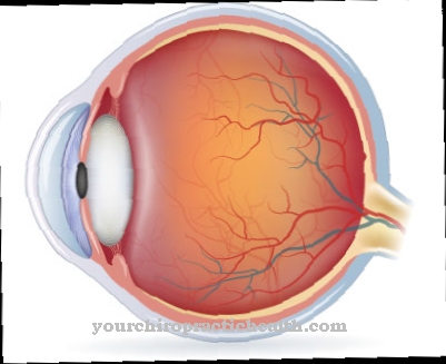 Leber amaurosis แต่กำเนิด