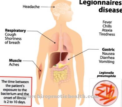 Bệnh Legionnaires '(bệnh legionellosis)