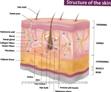 Lichen sclerosus