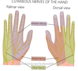 Loge de Guyon syndrome