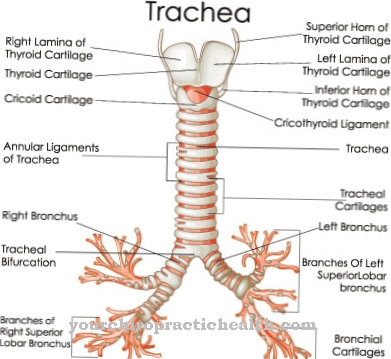 Inflamación de la tráquea.