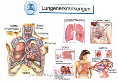 ฝีในปอด