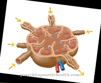 Lymfadenopati