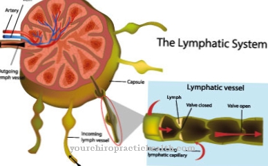 Lymphangioma