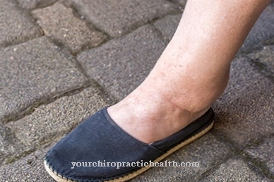 Lymphedema