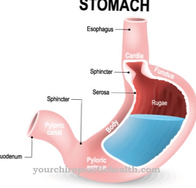 Gastric perforation