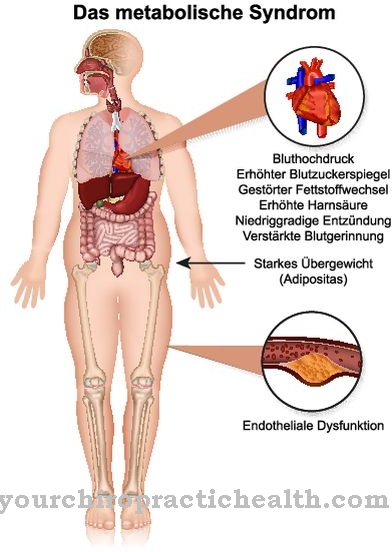 Sindrom metabolik