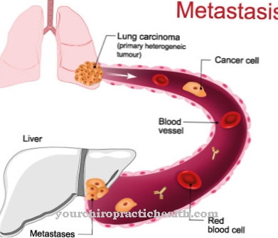 Metastāzes