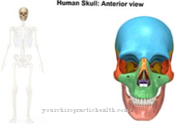 Microcephaly