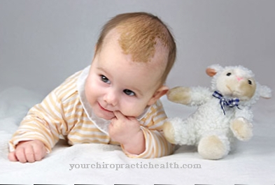 Cradle cap