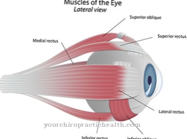 Miller-Fishers syndrom