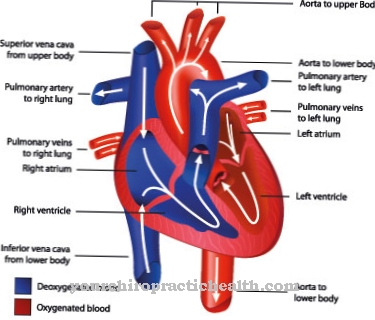 Insuficiencia de la válvula mitral