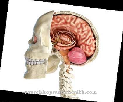 Midbrain syndrome