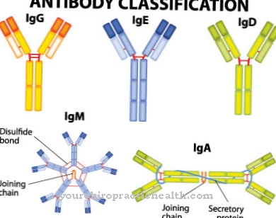 Monoclonal gammopathy