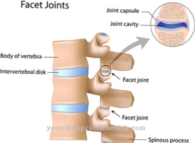 ankylozující spondylitida