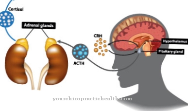 Cushing's disease