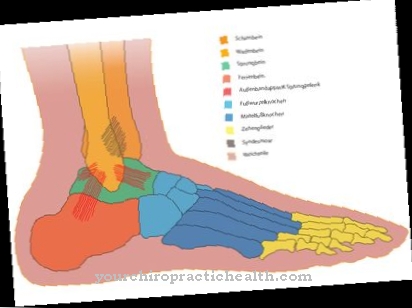 Köhler's disease II