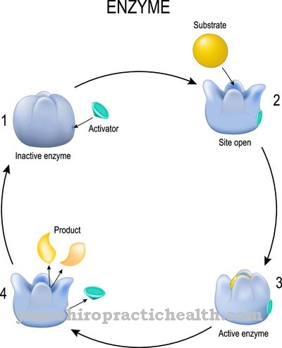 Morquio's disease