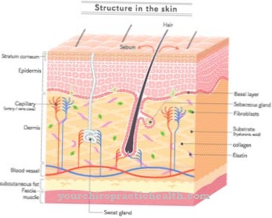 Osler's disease