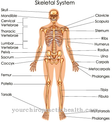 Paget's disease