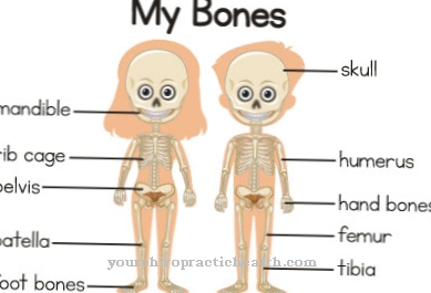 Perthes disease