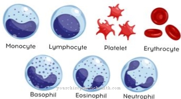 Waldenström's disease