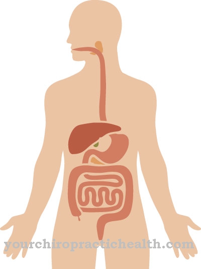 Motility disorder