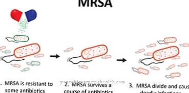 זיהום MRSA