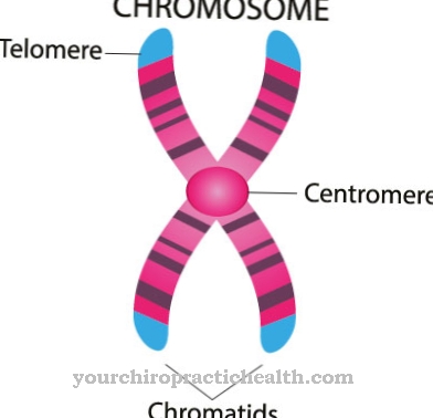 Muckle Wells Syndrome