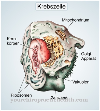 Multiple endocrine neoplasia